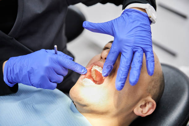 Best Broken Tooth Emergency  in Glandorf, OH