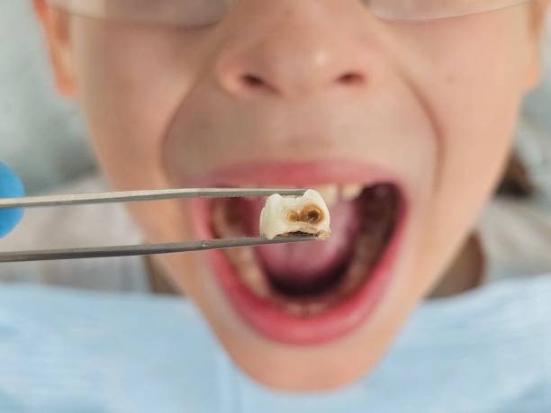 Best Emergency Pediatric Dentist  in Glandorf, OH
