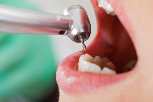 Best Knocked-Out Tooth Emergency  in Glandorf, OH